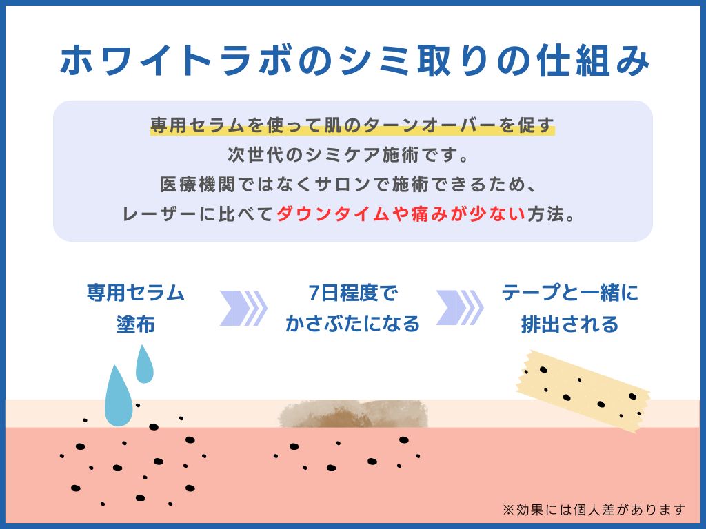 ホワイトラボのシミ取りの口コミ！効果や料金まとめ【店舗一覧】
