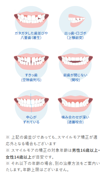 スマイルモア矯正対応範囲