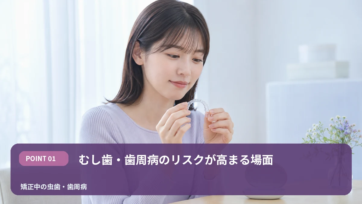 むし歯・歯周病のリスクが高まる場面を解説するイメージ